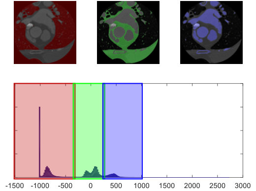 Figure 23